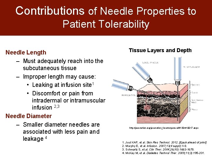 Contributions of Needle Properties to Patient Tolerability Needle Length – Must adequately reach into