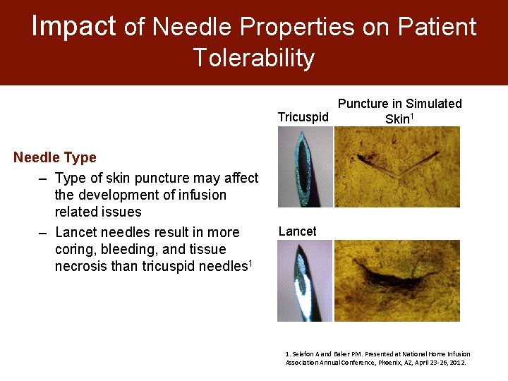 Impact of Needle Properties on Patient Tolerability Puncture in Simulated Tricuspid Skin 1 Needle