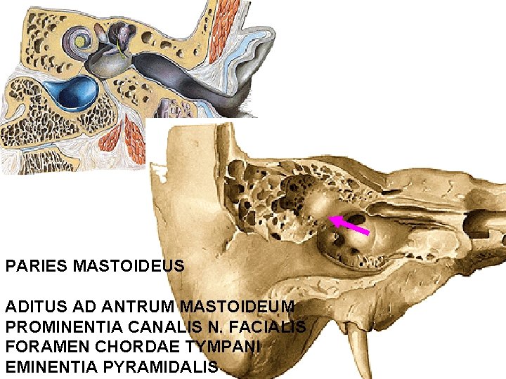 PARIES MASTOIDEUS ADITUS AD ANTRUM MASTOIDEUM PROMINENTIA CANALIS N. FACIALIS FORAMEN CHORDAE TYMPANI EMINENTIA