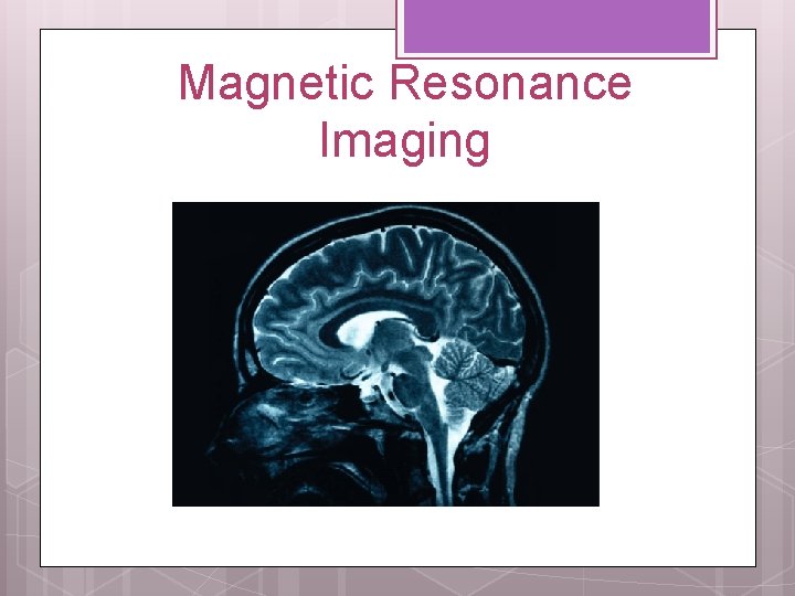 Magnetic Resonance Imaging 