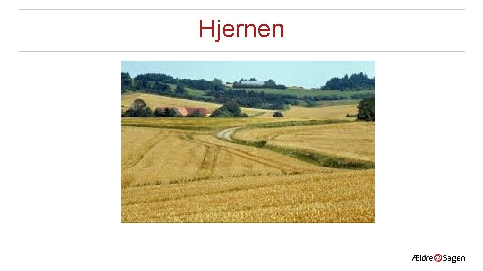 Hjernen 