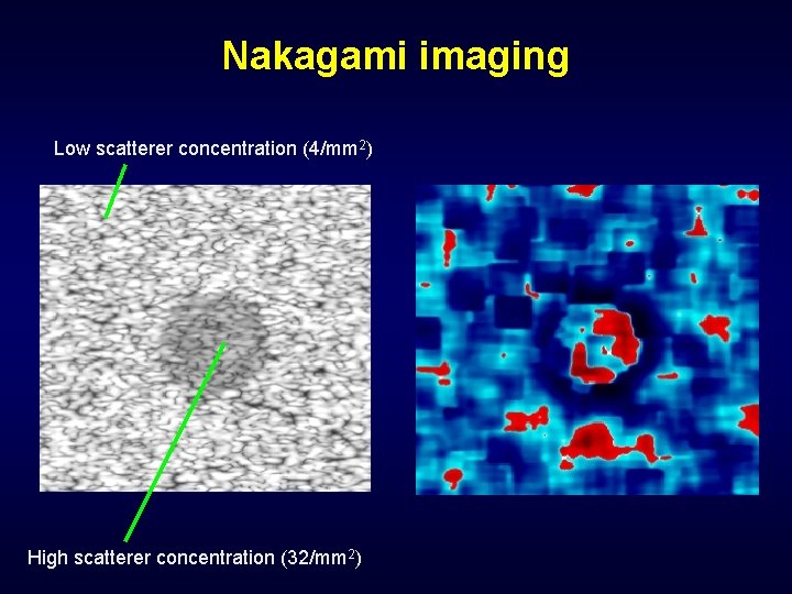 Nakagami imaging Low scatterer concentration (4/mm 2) High scatterer concentration (32/mm 2) 