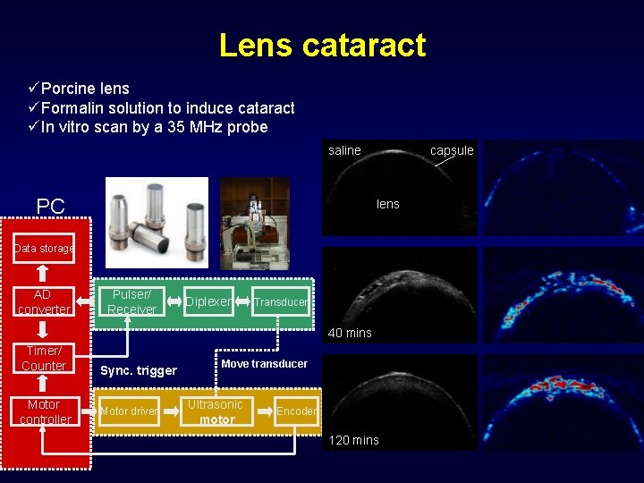 Lens cataract üPorcine lens üFormalin solution to induce cataract üIn vitro scan by a