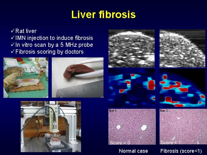 Liver fibrosis üRat liver üIMN injection to induce fibrosis üIn vitro scan by a