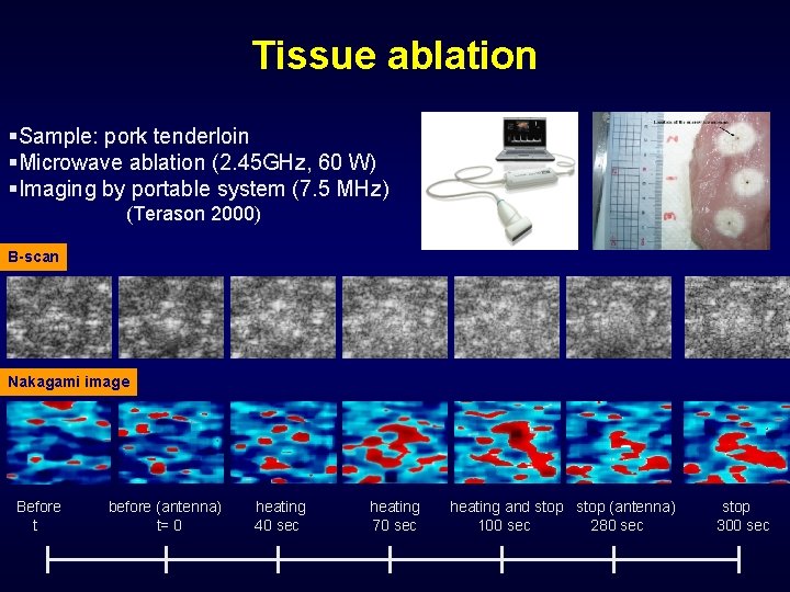Tissue ablation §Sample: pork tenderloin §Microwave ablation (2. 45 GHz, 60 W) §Imaging by