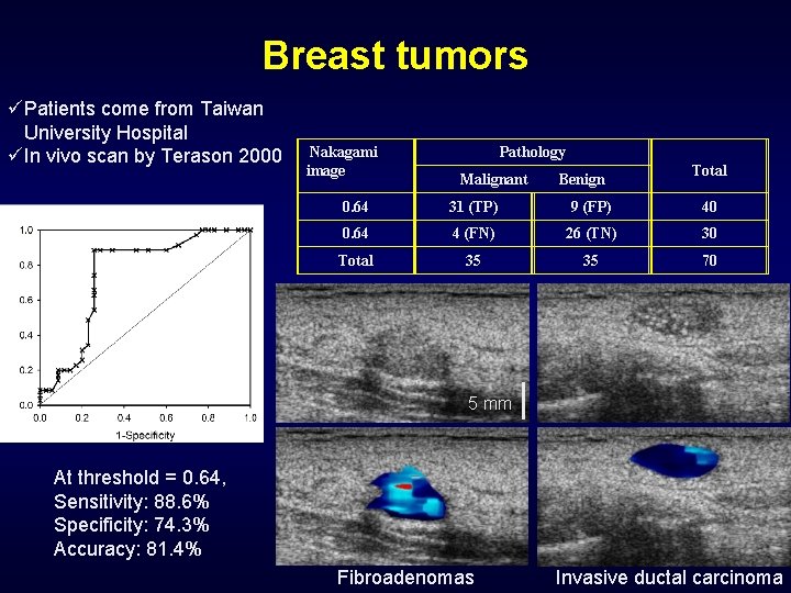 Breast tumors üPatients come from Taiwan University Hospital üIn vivo scan by Terason 2000