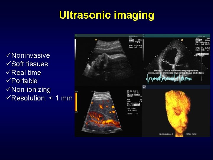 Ultrasonic imaging üNoninvasive üSoft tissues üReal time üPortable üNon-ionizing üResolution: < 1 mm 