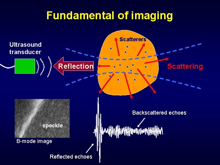 Fundamental of imaging Scatterers Ultrasound transducer Reflection Scattering Backscattered echoes speckle B-mode image Reflected