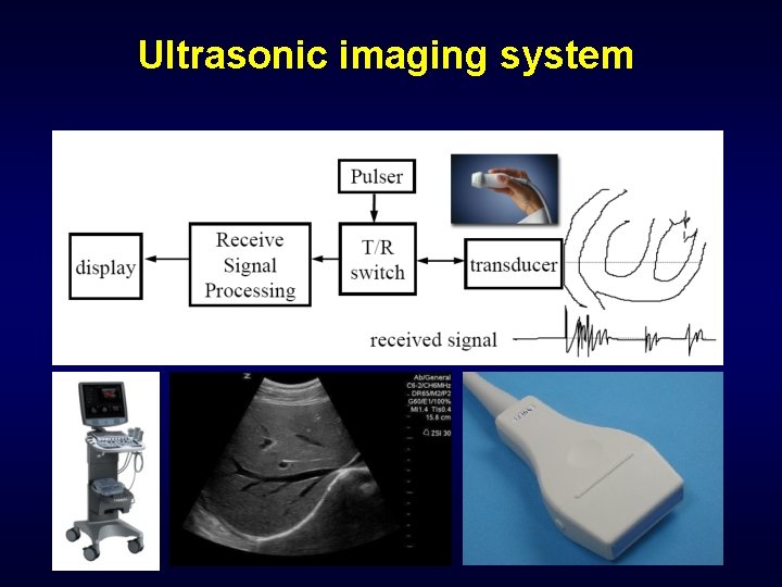Ultrasonic imaging system 