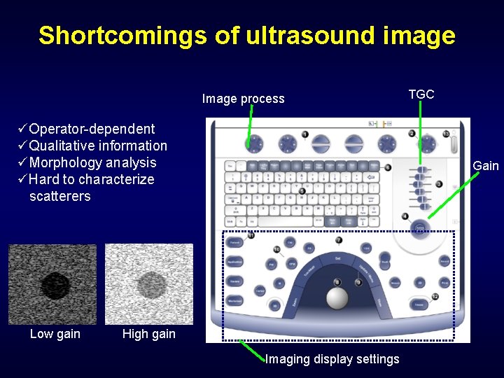 Shortcomings of ultrasound image Image process üOperator-dependent üQualitative information üMorphology analysis üHard to characterize