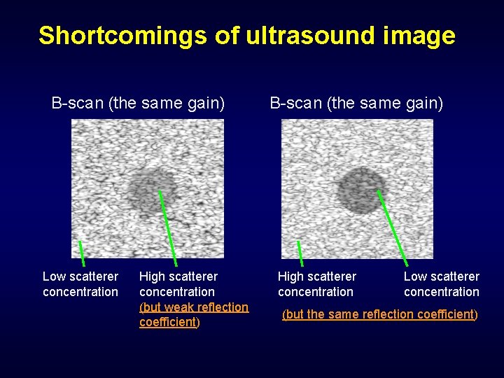 Shortcomings of ultrasound image B-scan (the same gain) Low scatterer concentration High scatterer concentration
