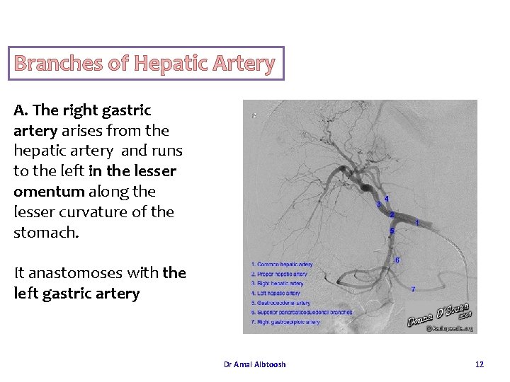 Branches of Hepatic Artery A. The right gastric artery arises from the hepatic artery Branches of Hepatic Artery A. The right gastric artery arises from the hepatic artery