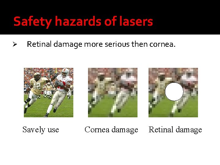 Safety hazards of lasers Ø Retinal damage more serious then cornea. Savely use Cornea