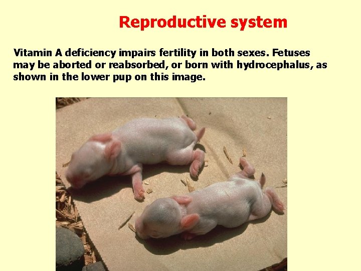 Reproductive system Vitamin A deficiency impairs fertility in both sexes. Fetuses may be aborted