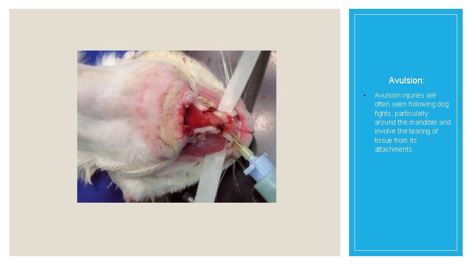 Avulsion: • Avulsion injuries are often seen following dog fights, particularly around the mandible