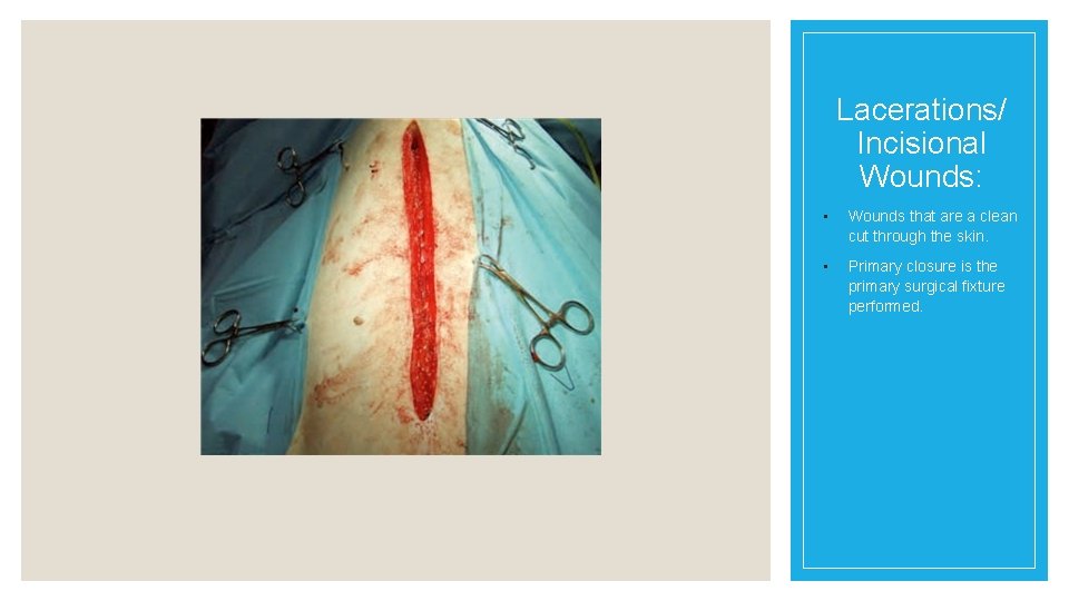 Lacerations/ Incisional Wounds: • Wounds that are a clean cut through the skin. •