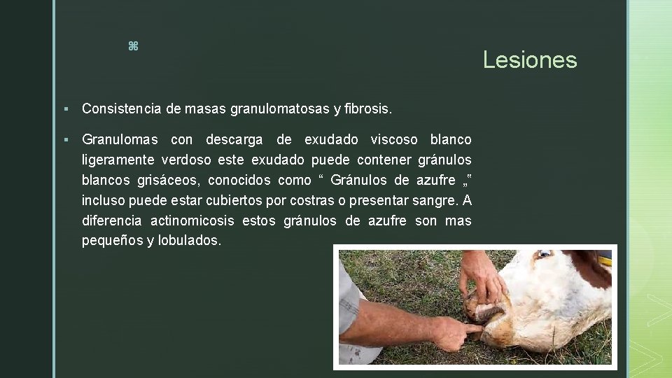 z § Consistencia de masas granulomatosas y fibrosis. § Granulomas con descarga de exudado