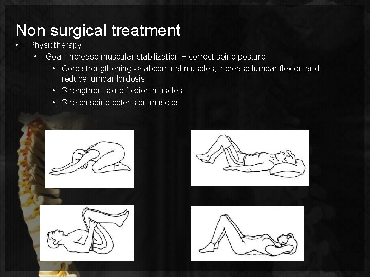 Non surgical treatment • Physiotherapy • Goal: increase muscular stabilization + correct spine posture