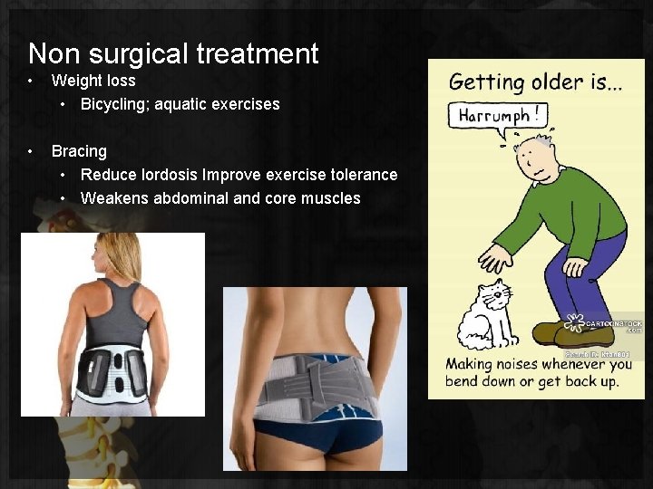 Non surgical treatment • Weight loss • Bicycling; aquatic exercises • Bracing • Reduce
