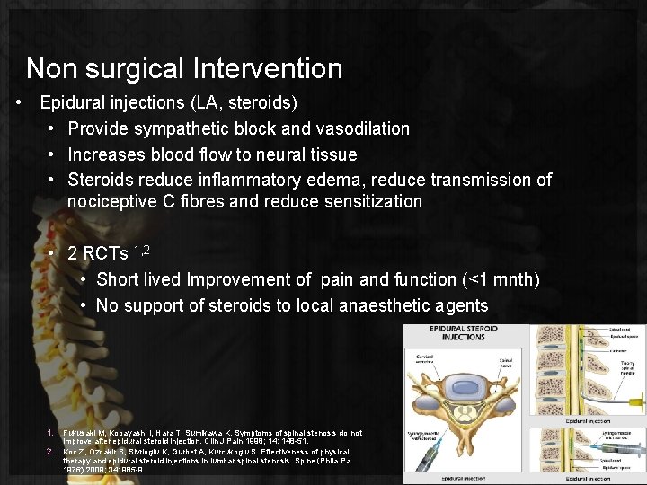 Non surgical Intervention • Epidural injections (LA, steroids) • Provide sympathetic block and vasodilation