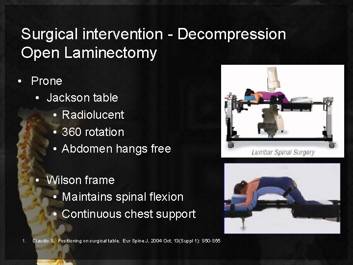 Surgical intervention - Decompression Open Laminectomy • Prone • Jackson table • Radiolucent •