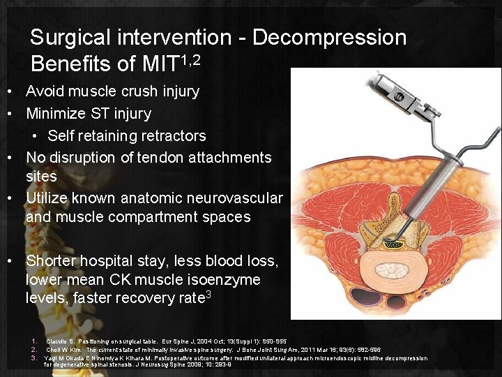 Surgical intervention - Decompression Benefits of MIT 1, 2 • Avoid muscle crush injury