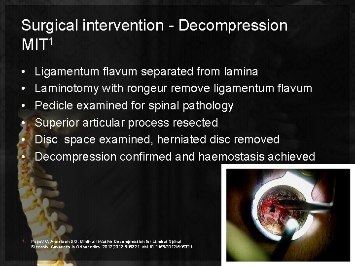 Surgical intervention - Decompression MIT 1 • • • 1. Ligamentum flavum separated from