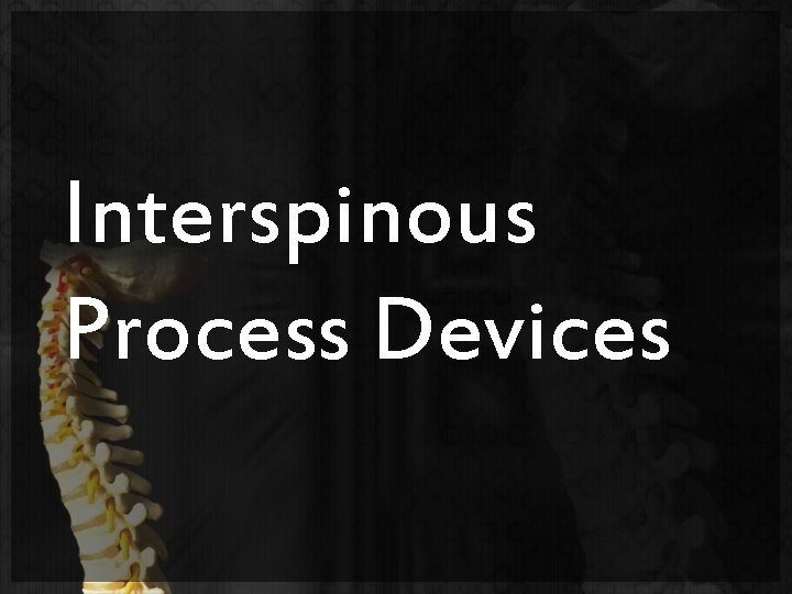 Interspinous Process Devices 