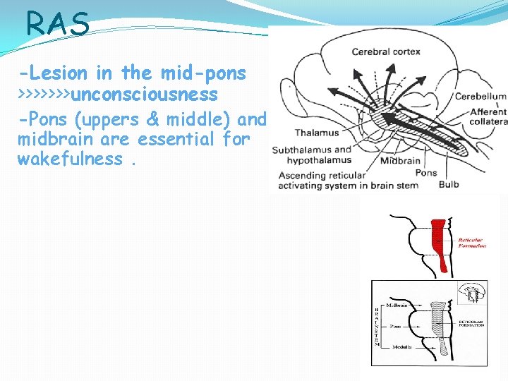 RAS -Lesion in the mid-pons >>>>>>>unconsciousness -Pons (uppers & middle) and midbrain are essential