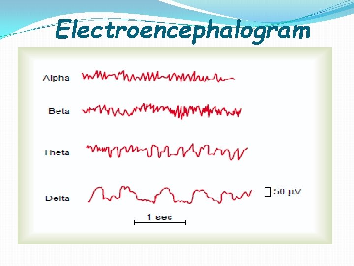 Electroencephalogram 