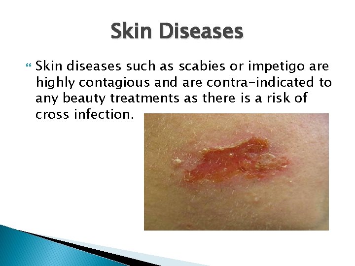 Skin Diseases Skin diseases such as scabies or impetigo are highly contagious and are