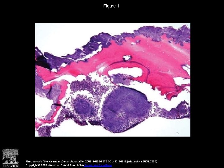 Figure 1 The Journal of the American Dental Association 2009 140864 -875 DOI: (10.