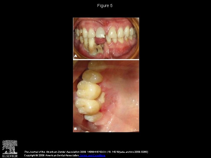 Figure 5 The Journal of the American Dental Association 2009 140864 -875 DOI: (10.