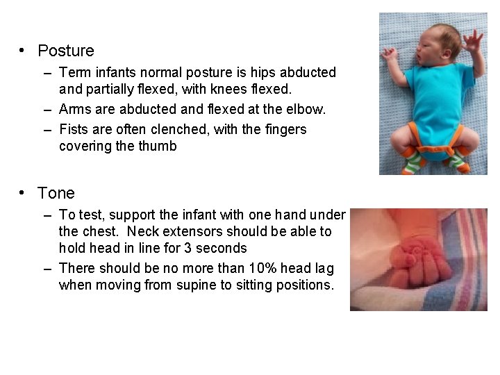  • Posture – Term infants normal posture is hips abducted and partially flexed,