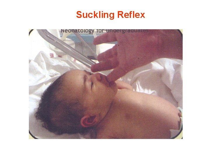 Suckling Reflex 