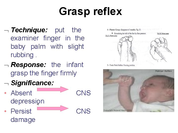 Grasp reflex Technique: put the examiner finger in the baby palm with slight rubbing.