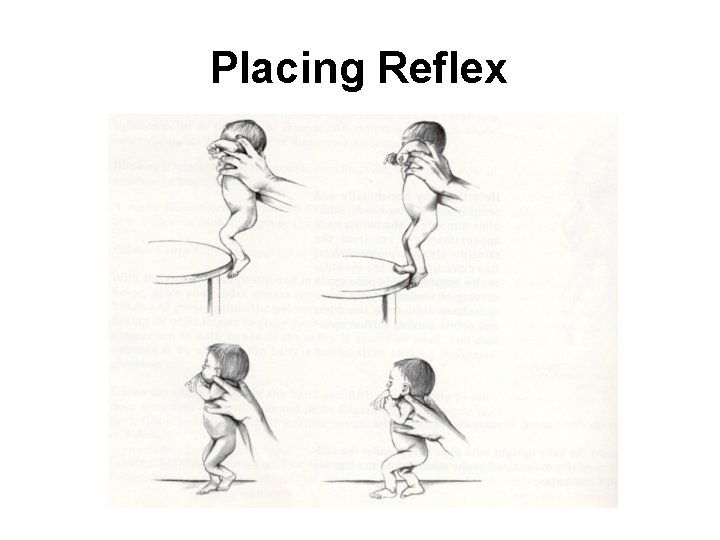 Placing Reflex 