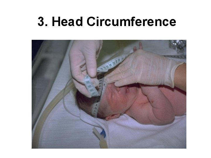 3. Head Circumference 