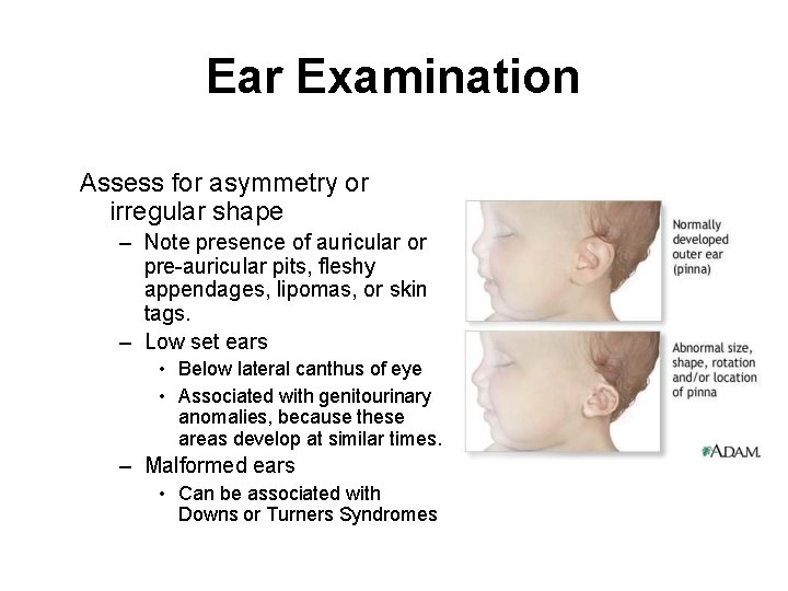 Ear Examination Assess for asymmetry or irregular shape – Note presence of auricular or