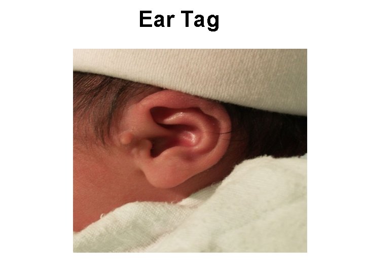 Ear Tag 