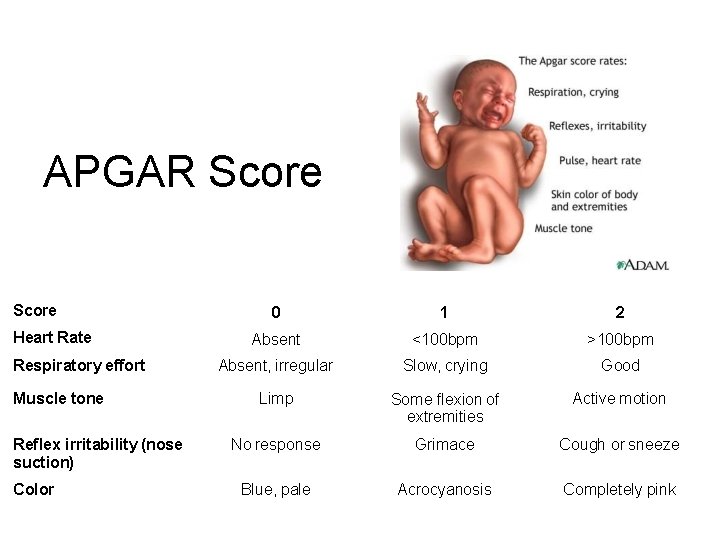 APGAR Score Heart Rate Respiratory effort Muscle tone Reflex irritability (nose suction) Color 0