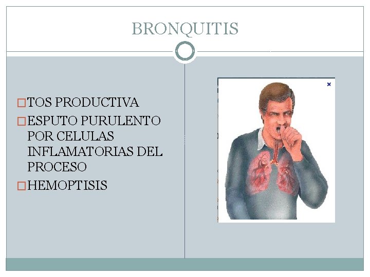BRONQUITIS �TOS PRODUCTIVA �ESPUTO PURULENTO POR CELULAS INFLAMATORIAS DEL PROCESO �HEMOPTISIS 