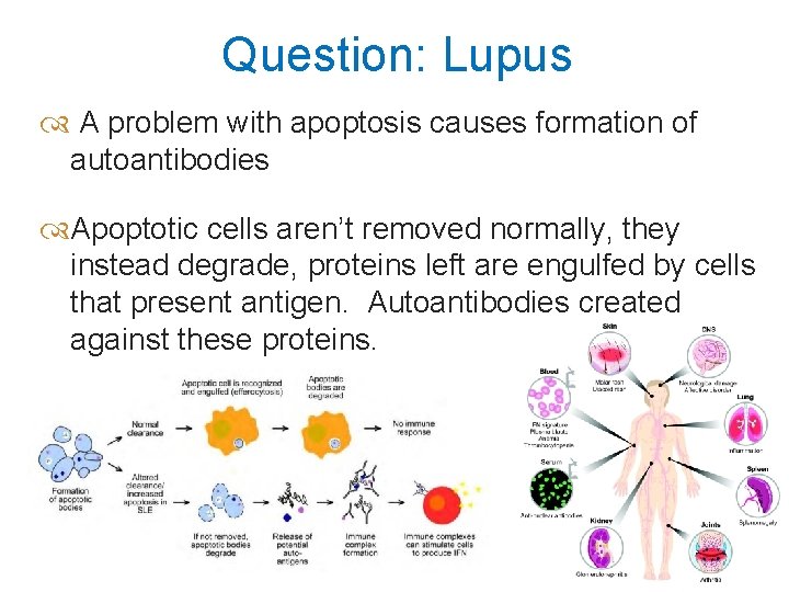 Question: Lupus A problem with apoptosis causes formation of autoantibodies Apoptotic cells aren’t removed
