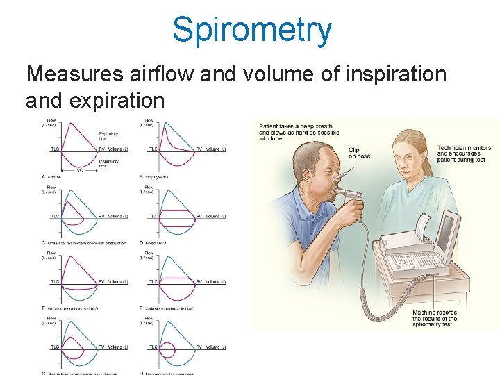 Spirometry Measures airflow and volume of inspiration and expiration 