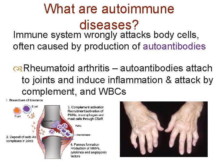 What are autoimmune diseases? Immune system wrongly attacks body cells, often caused by production