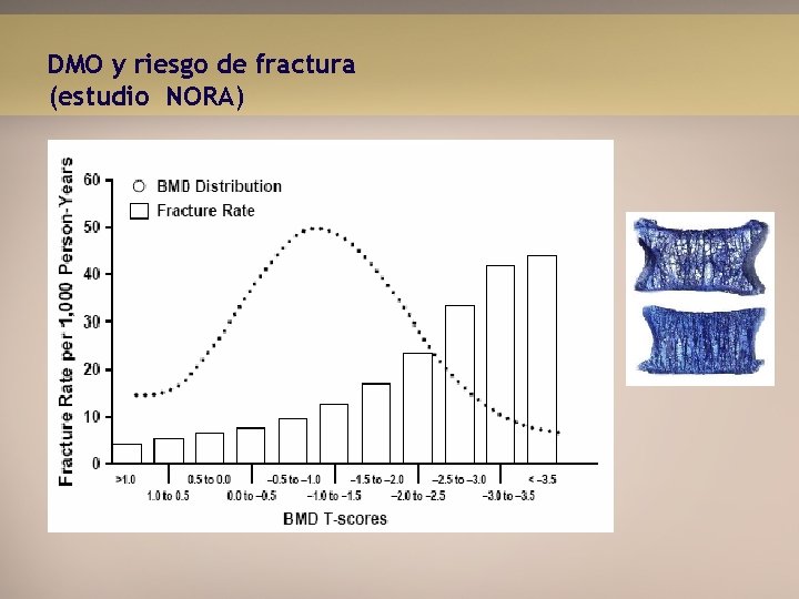 DMO y riesgo de fractura (estudio NORA) 