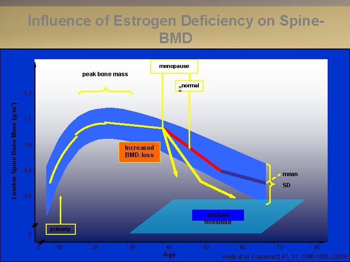 Influence of Estrogen Deficiency on Spine. BMD menopause peak bone mass „normal “ Lumber