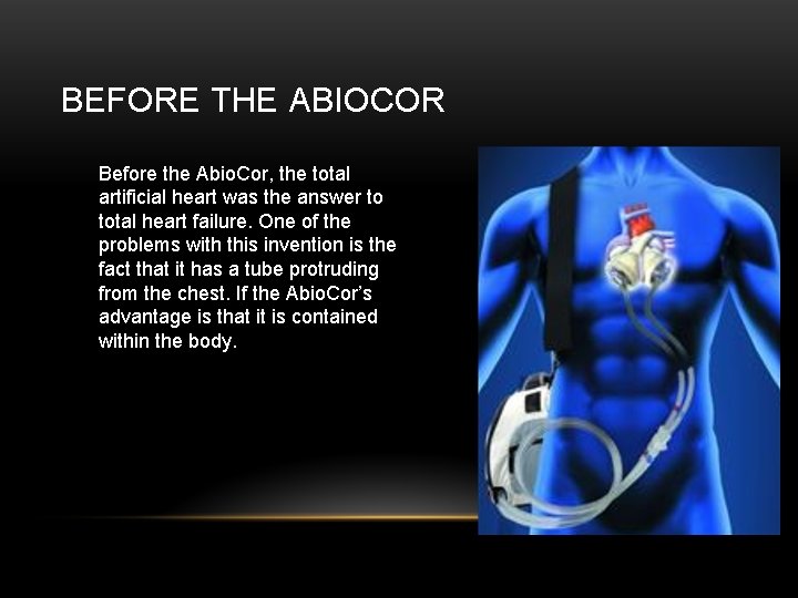 BEFORE THE ABIOCOR Before the Abio. Cor, the total artificial heart was the answer