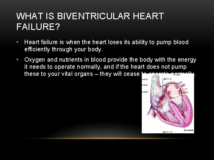 WHAT IS BIVENTRICULAR HEART FAILURE? • Heart failure is when the heart loses its