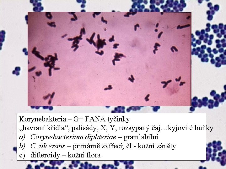 Korynebakteria – G+ FANA tyčinky „havraní křídla“, palisády, X, Y, rozsypaný čaj…kyjovité buňky a)